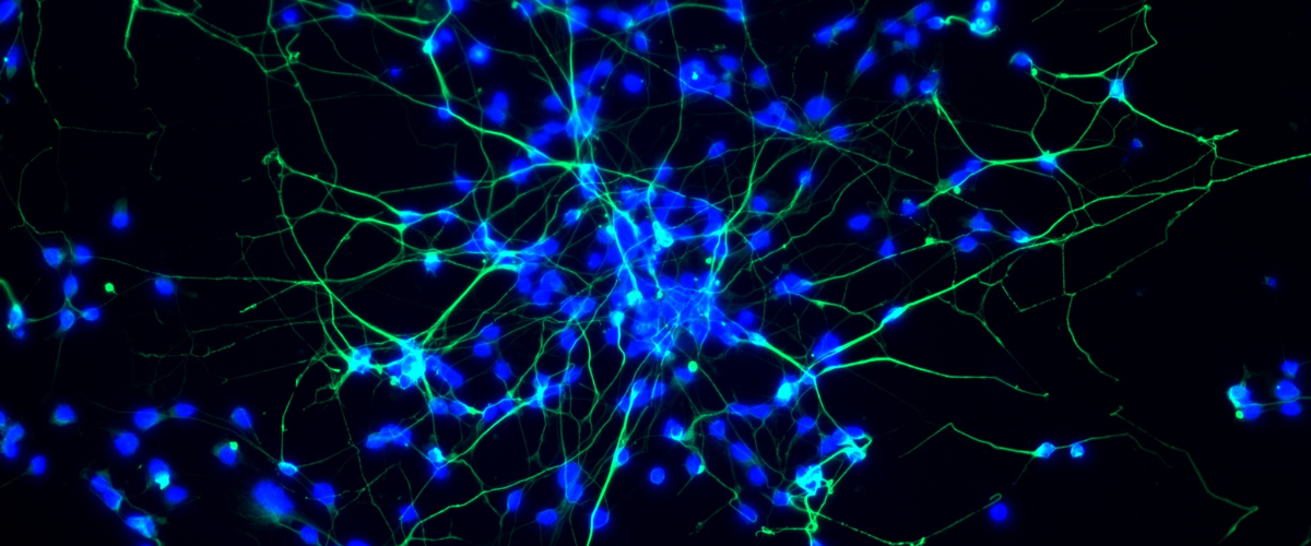 Réseau de neurones